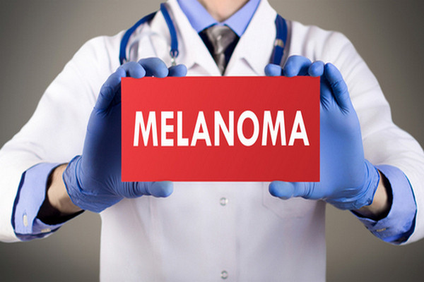 Cílená léčba a imunoterapie výrazně prodlužuje přežití pacientů s pokročilým melanomem